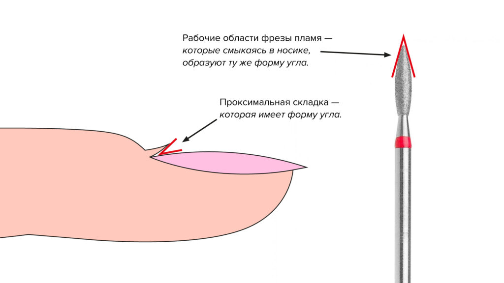 Как выбрать правильную форму фрезы, оптимальная фреза для удаления птеригия — пламя